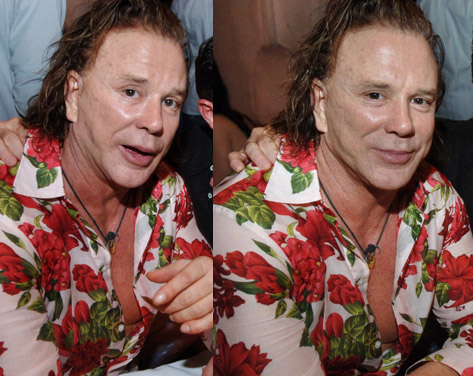 Plastic Surgery Before And After Korean: Mickey Rourke - Bad Plastic